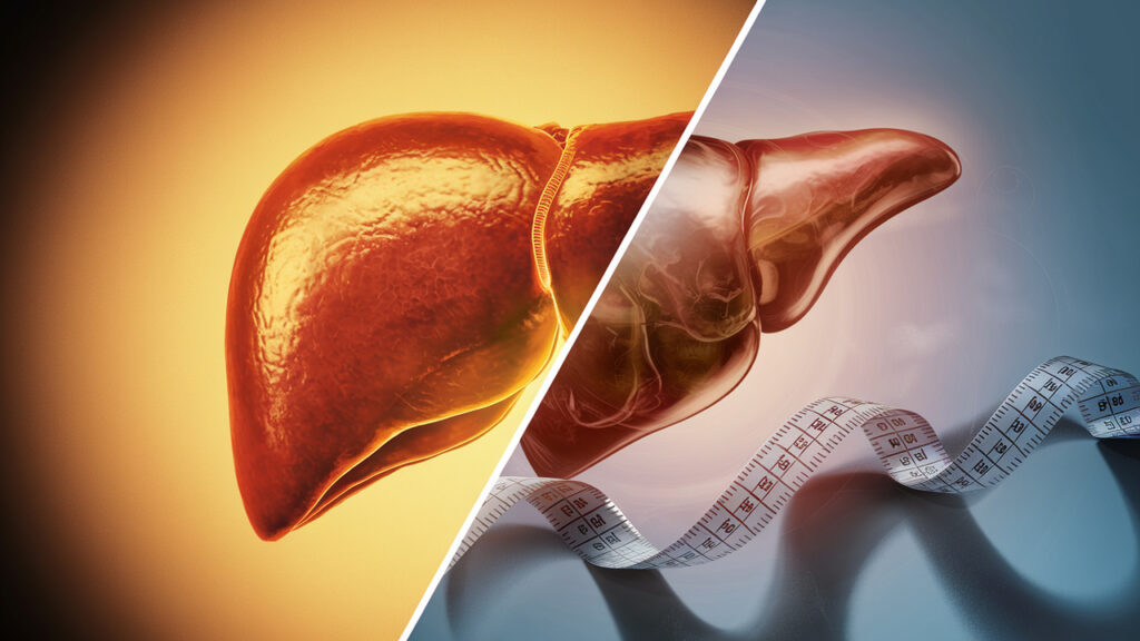 Why Your Liver Might Be the Missing Link in Your Weight Loss Journey