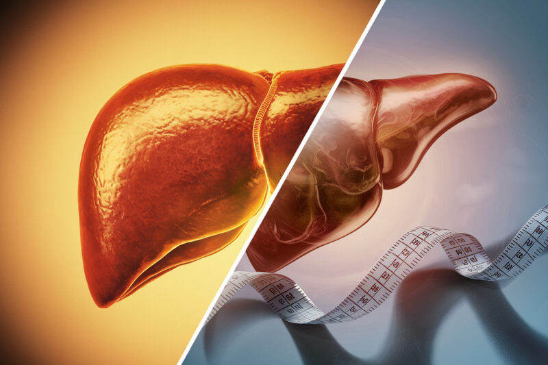Why Your Liver Might Be the Missing Link in Your Weight Loss Journey