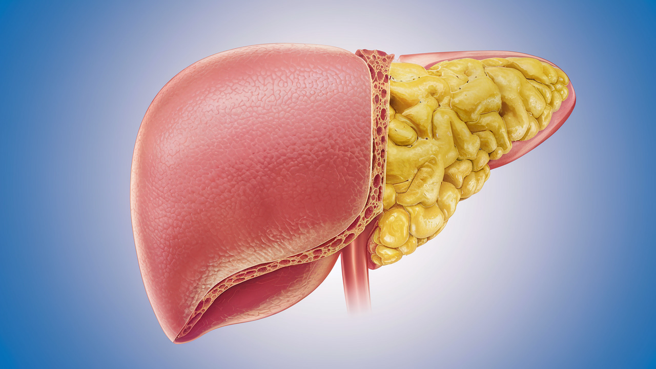 Liver Fat Explained: What It Is, Why You Have It, and How to Burn It