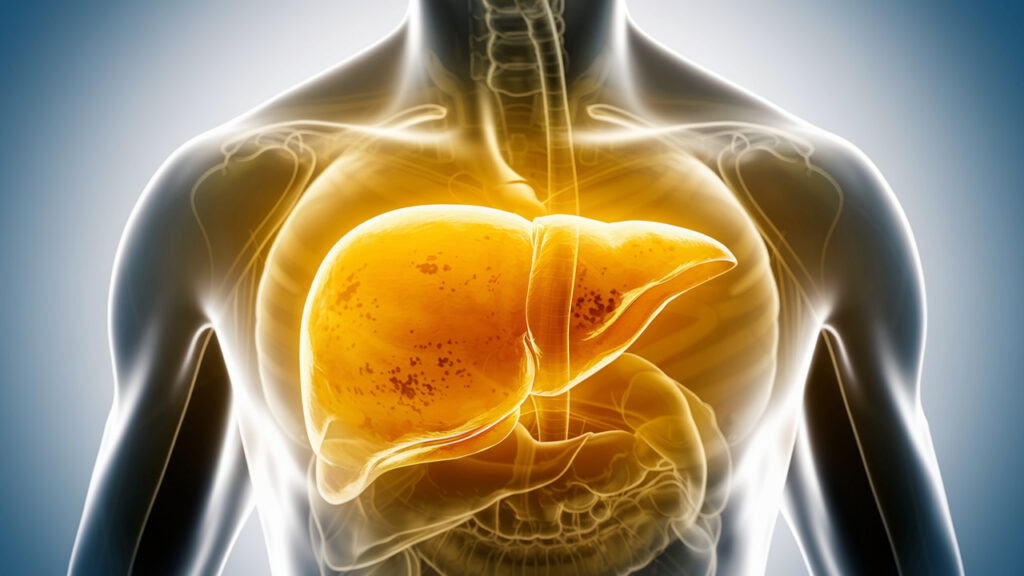 How to Know if Your Liver Is Overloaded — and What to Do Next
