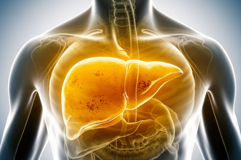 How to Know if Your Liver Is Overloaded — and What to Do Next
