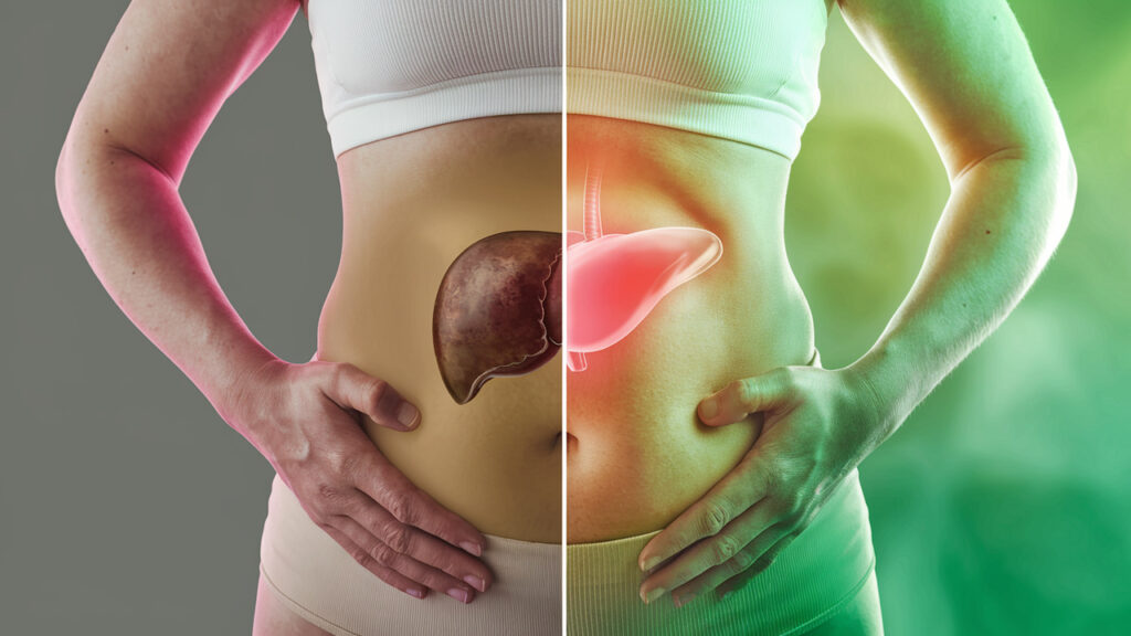 What Happens to Belly Fat When You Heal Your Liver