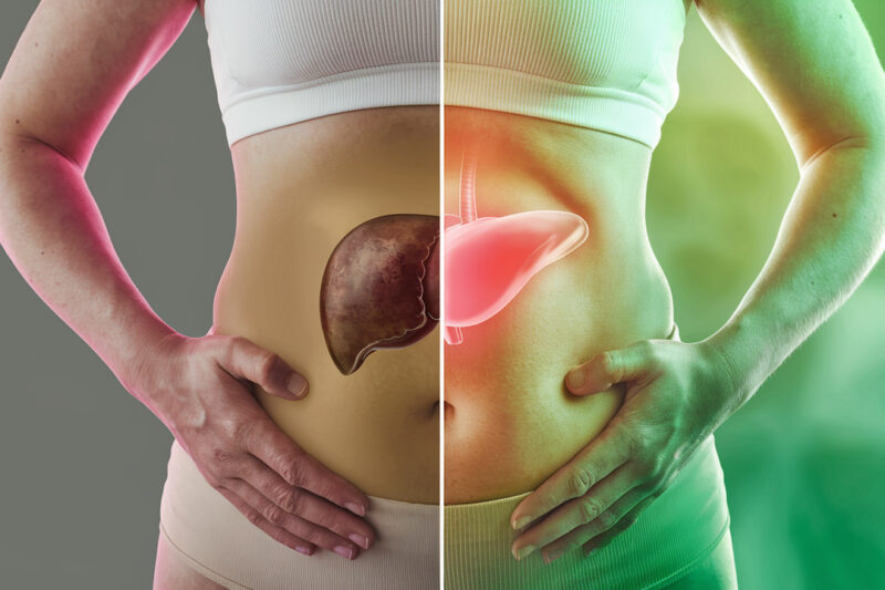 What Happens to Belly Fat When You Heal Your Liver