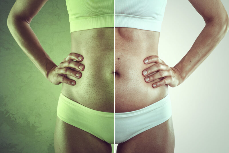 How to Tell if Your Body Is Holding on to Fat Due to Toxin Buildup